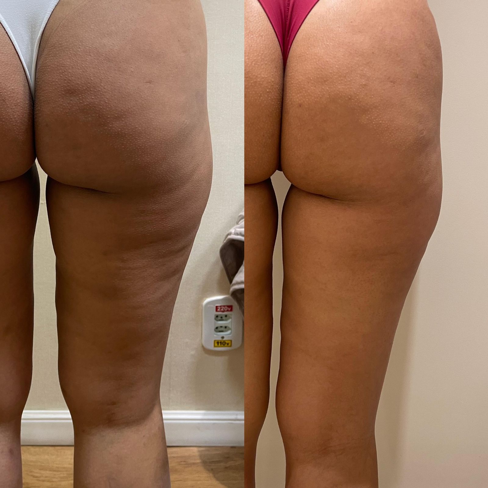 Antes e depois corporal