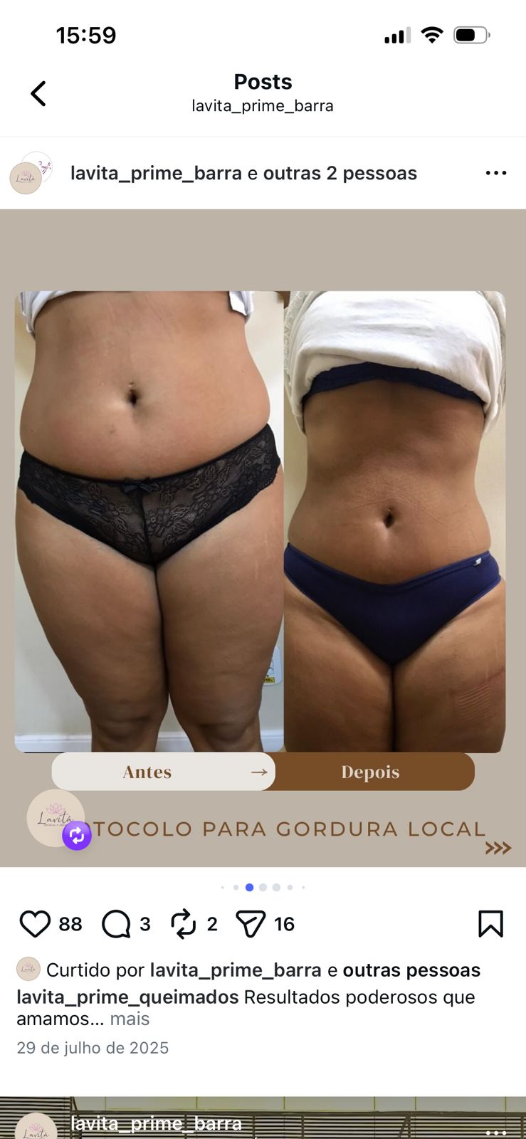 Antes e depois corporal