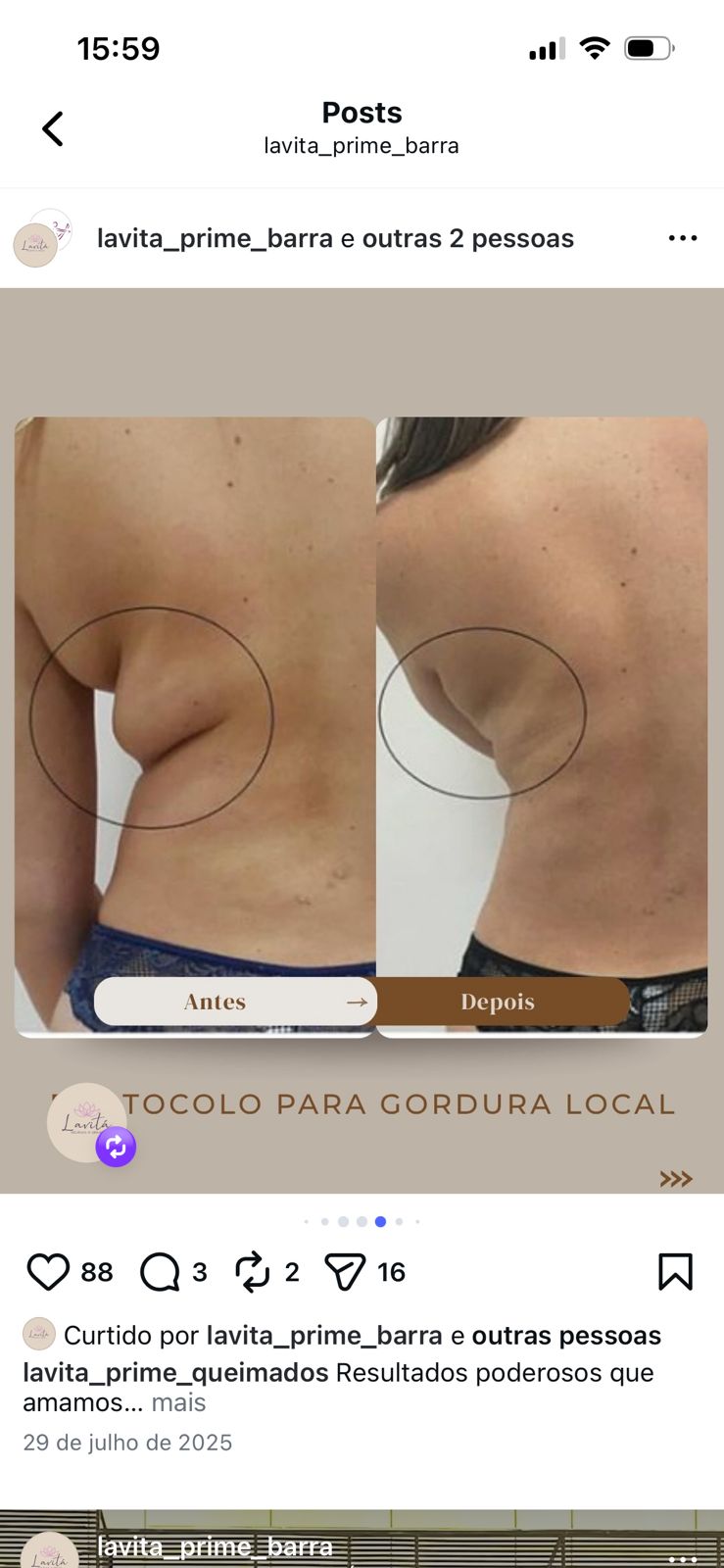 Registro de cuidado corporal na região das costas